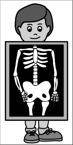 Xray Clip Art Black And White